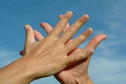 Two hands, skin disorder