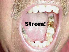 Wenn Menschen Amalgamfllungen und
                            Goldfllungen gleichzeitig im Mund haben, so
                            entsteht Strom mit elektrischen Feldern