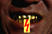 Metallzhne oder Metallfllungen
                          im Mund verursachen automatisch
                          unterschwellige Strme, die den Zellen schaden
                          und so dem gesamten Organismus schaden knnen