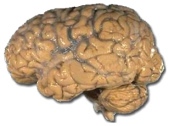 Gehirne von Alzheimer-Menschen sind
                              massiv hher mit Quecksilber belastet als
                              Menschen, die an anderen Todesursachen
                              sterben