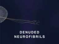 Film ber
                                        Quecksilberwirkung an Nerven 09:
                                        Es bleiben nur noch nackte
                                        Nervenfasern (engl.:
                                        "denuded
                                        neurofibrils") brig