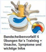 Bandscheibenvorfall: Der Faserring
                              ist gerissen, der Gallertkern gelangt nach
                              draussen und drckt auf einen Nerv -
                              Schema