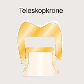 Corona: La corona
                              de telescopio es la corona para el diente
                              molar, con una parte debajo y encima
                              ("corona doble") [35].