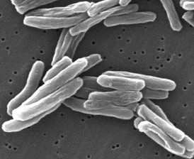 Tuberculosis pathogen (threads)