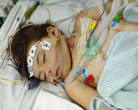 La nia Chloe Ashman despus
                                    del ataque en la unidad de
                                    vigilancia intensiva, julio 2008
                                    [66]