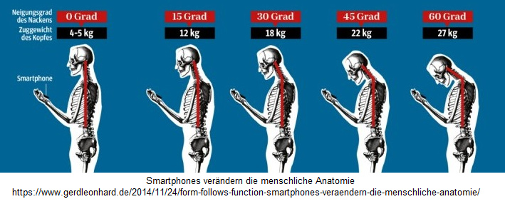 Der Handy-Buckel: Handysucht und iPhone-Sucht
                provoziert einen Buckel mit bis zu 27kg Gewicht an der
                Wirbelsule