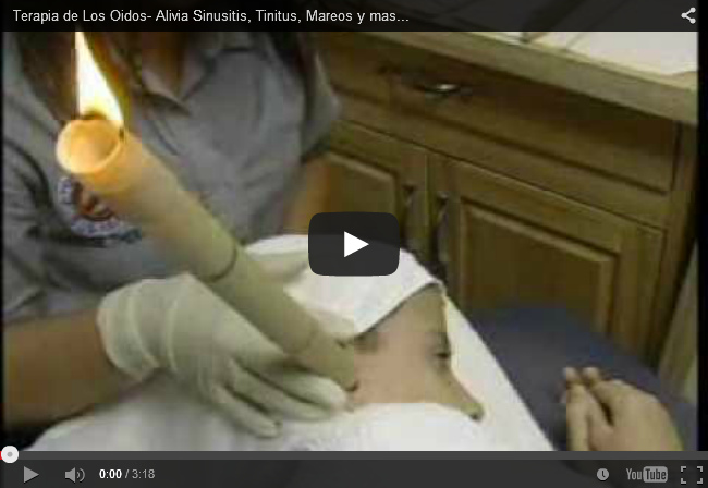 V�deo: Terapia de Los Oidos- Alivia Sinusitis,
            Tinitus, Mareos y mas... (3min.17seg.)